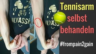 Tennisarm  Tennisellenbogen selbst behandeln  3 Methoden die funktionieren│Mischa Kotlyar [upl. by Hayimas]