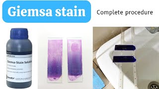 Giemsa Stain Procedure for Blood SmearHow to do Giemsa StainGiemsa Staining ProcedureAdnanMLT [upl. by Ardnik]