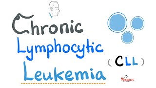 Chronic Lymphocytic Leukemia CLL  Etiology Risk Factors Symptoms Signs Diagnosis Treatment [upl. by Hollah128]