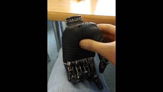 BeBionic V3 Hand Prosthesis by Otto Bock [upl. by Spense289]