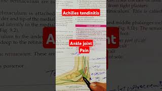 Achilles tendinitis shortvideo [upl. by Bellina]