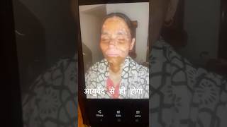 Vitiligo Recovery Incredible Transformation with Ayurveda [upl. by Dorcus]