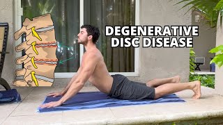 Degenerative Disc Disease Stretches for PainRelief [upl. by Atilamrac430]