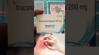 Itromil200  Itraconazole Capsule 200 mg  short ringworm medicinetuber viralshorts [upl. by Halac]