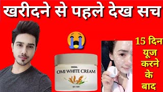 omi white cream honest review in hindi omi white cream side effects reviewomi white cream 2023 [upl. by Jacob]