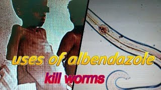 albendazole tabletwat is the doseside effects of albendazolewat r the uses of albendazole [upl. by Lizzy282]