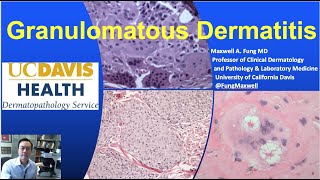 DERMATOPATHOLOGY Granulomatous Dermatitis [upl. by Uwton]