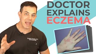 Five Types of Eczema According to a Dermatologist  208SkinDoc [upl. by Annitsirhc304]