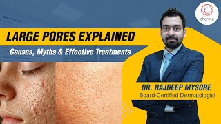 Effective Treatments for Large Pores What You Need to Know  Dr Rajdeep Mysore  Charma Clinic [upl. by Aytnahs]