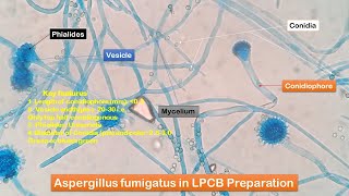 Aspergillus fumigatus growth on SDA and its LPCB Preparation showing conidia conidiophores phialid [upl. by Horsey]