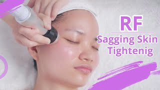 RF FACIAL NON SURGICAL FACELIFT  HOW TO USE RADIO FREQUENCY  FACE SKIN TIGHTENING TREATMENT 1391 [upl. by Semyaj634]