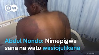 Nondo anazungumzia kutekwa kwake [upl. by Nerte]