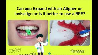 Arch Expansion vs Palatal Expansion [upl. by Atirb]