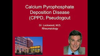 10 Calcium Pyrophosphate Deposition Disease Pseudogout [upl. by Mala]