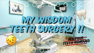 My Wisdom Teeth Removal Under IV Sedation  EveyQueen [upl. by Melesa]