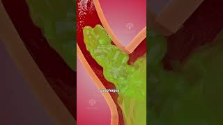 How acid reflux happens 🥵 Acidity and gas problem  GERD shorts viralvideo  creativelearning3d [upl. by Azeret]