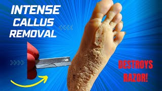 CALLUS REMOVAL [upl. by Asenad]