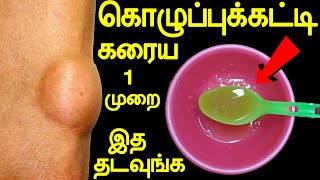 1 முறையில் கொழுப்புக் கட்டி கரைய இத தடவுங்க  kolupu katti  kozhuppukatti  health tips in tamil [upl. by Yenahs]