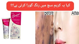 Glowpar whitening Cream Review  Medicated cream worth buying [upl. by Caylor991]