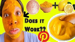 FUNGAL ACNE Face MASK DIY Turmeric Lemon Juice Face Mask DIY SkinCare [upl. by Retsek147]