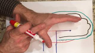 How to make a pattern for a Resting Pan Orthosis Volar Wrist Hand Finger Orthosis [upl. by Myriam]