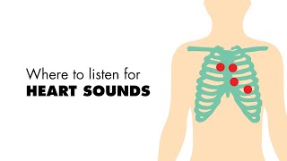 Where to listen for Heart Sounds Auscultory Areas  MEDZCOOL [upl. by Donoho]