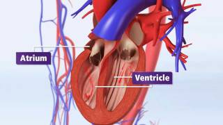 Atrial Fibrillation Animation Explained AFib amp Risk of Stroke [upl. by Soluk]