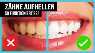 ▶︎ Zähne Aufhellen Weiße Zähne mit diesen 5 Methoden [upl. by Leihcim675]