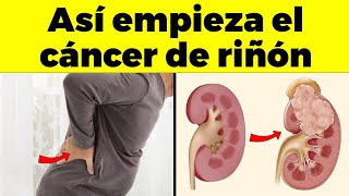 Así Empieza EL CÁNCER DE RIÑON Y Nadie Tiene Cuidado  Signos Y Síntomas de Cáncer Que Debes Conocer [upl. by Mayhs72]