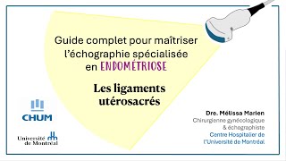 Échographie spécialisée en endométriose Les ligaments utérosacrés [upl. by Petulah]