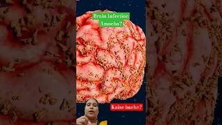 Naegleria Fowleri viralvideo science facts shortfeed shorts [upl. by Paten]