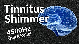 Tinnitus Shimmer  Sound Therapy Relief That WORKS [upl. by Haila]