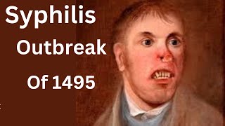 Europes 1495 Syphilis Outbreak The Untold Story [upl. by Maxfield841]