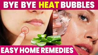 முகத்தில் ஏற்படும் சூட்டு கொப்பளதிற்கு பாட்டி வைத்தியம்  Heat Boils Home Remedy Tamil  IBC Mangai [upl. by Ananna]