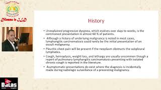 Pulmonary Lymphangitis Carcinomatosis [upl. by Ahterahs169]