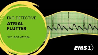 Atrial Flutter  EKG Detective [upl. by Yesnek]