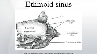 Ethmoid sinus [upl. by Baptiste994]