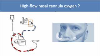 Should we use NIV or HFNC for acute hypoxaemic respiratory failure [upl. by Atinet820]