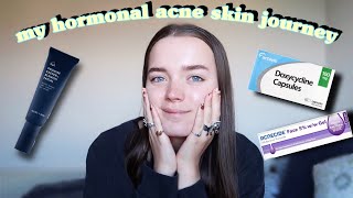 my hormonal acne skin journey  experience on doxycycline🌿🪐 [upl. by Noivaz]