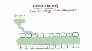 Primary biliary cholangitis causes symptoms diagnosis treatment amp pathology [upl. by Sabanrab]