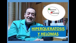 Hiperqueratosis y helomas [upl. by Nobe]