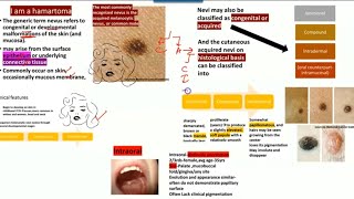 Oral nevi  Nevus HISTOPATHOLOGYjunctionalcompound and intradermalClinical features [upl. by Lilhak]