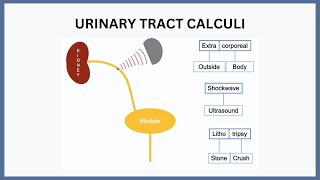 Urinary Tract Calculi Explained [upl. by Roderick]