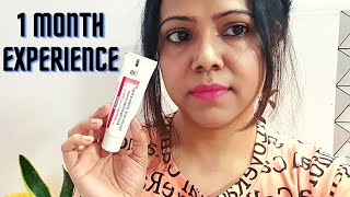 My 1 Month Experience with Demelan Cream  Honest Review [upl. by Ziom]