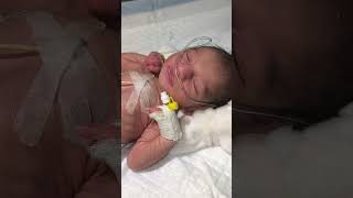 Newborn baby moving his lips youtubeshorts nursing medical newbornbaby cutebaby viralvideo [upl. by Eiznil]