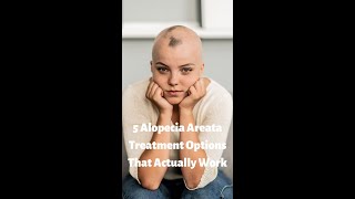 5 Alopecia Areata Treatment Options that Actually Work shorts [upl. by Enois]