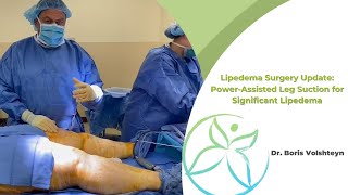 Lipedema Surgery Update PowerAssisted Leg Suction for Significant Lipedema  Dr Boris Volshteyn [upl. by Jara692]