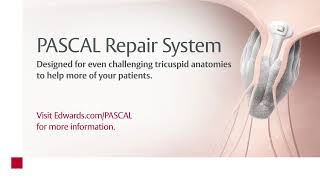 The PASCAL Repair System  designed for challenging tricuspid anatomies  Animation [upl. by Anoyi307]