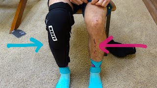 MTB KNEE PAD SHIN GUARD UNBOXING amp REVIEW  ION KPACT SELECT  Ep 39 [upl. by Labaw168]