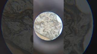 Human Skin Cells Under Microscope magnification microscope science shorts sciencelab [upl. by Anuala]